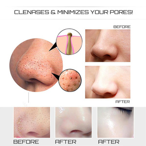 <span class=keywords><strong>เครื่อง</strong></span><span class=keywords><strong>ดูด</strong></span>สิวเสี้ยนแบบมือถือสำหรับใช้ในบ้าน ได้รับการรับรองมาตรฐานระดับมืออาชีพ สำหรับทำความสะอาดรูขุมขนบนใบหน้า - Product Image 4