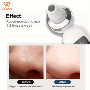 PAKISS Electric Plastic Blackhead Remover Facial Pore <b>Cleaner</b> <b>Nose</b> Suction Rechargeable Vacuum Remover Set - Product Image 3
