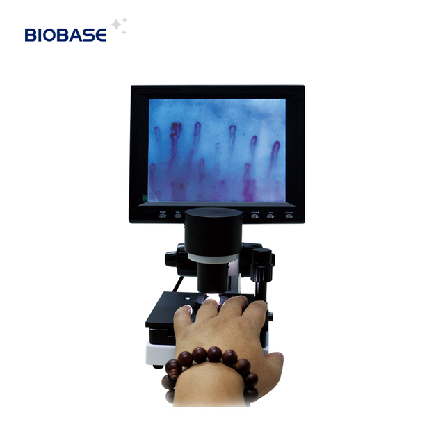 Biobase Microcirculation Microscope  WXH-8 Capillary Microscope Darkfield Live Blood Analysis Microscope for Laboratory