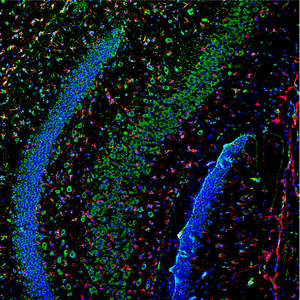 <span class=keywords><strong>Microscope</strong></span> <span class=keywords><strong>confocal</strong></span> <span class=keywords><strong>laser</strong></span> <span class=keywords><strong>à</strong></span> <span class=keywords><strong>balayage</strong></span> par résonance haute vitesse Bestscope BCF296R pour la recherche en sciences de la vie - Product Image 5