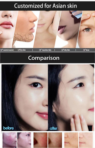 ปืนเมโสออกซิเจนแบบไม่ใช้เข็มสำหรับร้านเสริมสวยเครื่องพ่นออกซิเจนเมโสแบบไม่ใช้ออกซิเจนเจ็ทคอลลาเจนสร้างใบหน้าใหม่ช่วยให้ผิวกระจ่างใสต่อต้านริ้วรอยแห่งวัย2026 - Product Image 5