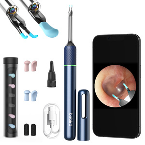 เครื่องทำความสะอาดหูไร้สายสำหรับโน้ต 5 พร้อมกล้องดูดขี้หูแบบมือถือ ควบคุมด้วยรีโมทอัตโนมัติและเลนส์ CMOS - Product Image 1