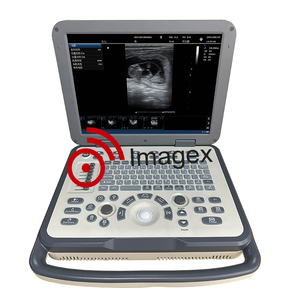 Sistem <span class=keywords><strong>Combo</strong></span> <span class=keywords><strong>Ultrasound</strong></span> Doppler hitam & putih Laptop - Product Image 4