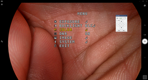 Kamera Endoskopi USB Portabel Digunakan dengan Komputer untuk Endoskop Rigid Storz THT - Product Image 6