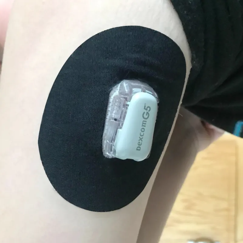 เซนเซอร์ลดอาการแพ้ G6 Dexcom แพทช์ผิว Dexcom G4