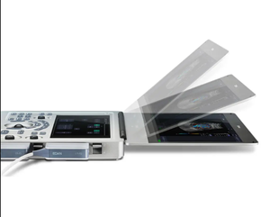 Ecógrafo Doppler Color Portátil Ligero Edan AX3 para Exámenes Vasculares, Obstétricos/Ginecológicos y Cardíacos - Product Image 1