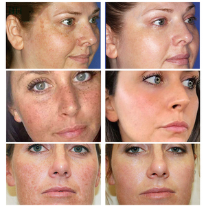 Crema Aclaradora de Pecas OEM de 7 Días, Elimina la Melanina, Pecas, Manchas Oscuras, Crema Blanqueadora Facial para Piel Negra - Product Image 2