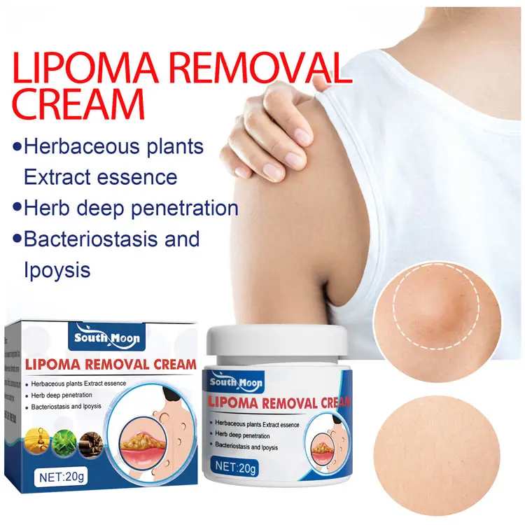 Private Label Lipoma Removal Cream Herbal Ingredients Relieve Lipoma mass Reduce Body Lump 20g