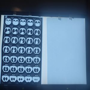 医療用<span class=keywords><strong>X</strong></span>線装置用PETインクジェット印刷可能<span class=keywords><strong>X</strong></span>線フィルム工場供給 - Product Image 1