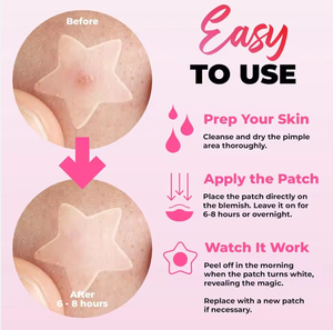 Parches Hidrocoloides Adhesivos para el Cuidado Facial, Parches para el Acné <span class=keywords><strong>con</strong></span> Diseño Holográfico, para Curar y Disimular, Barbados Heal - Product Image 2