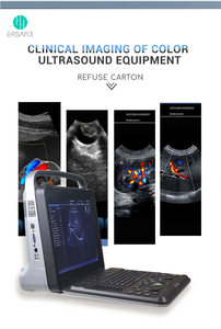 Draagbare Medische Echografie Instrument Sonografie Zwangerschap Laptop Veterinaire Echografie Machine - Product Image 6