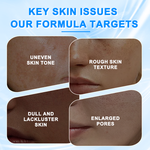 โทนเนอร์ OEM กรดไกลโคลิก ไวท์เทนนิ่ง ทำความสะอาดล้ำลึก ควบคุมความมัน ลดสิว ผสมไฮยาลูรอนิค แอซิด ผลัดเซลล์ผิว 150 มล. สำหรับทุกสภาพผิว - Product Image 3