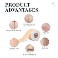 Bande et patchs de suppression des cicatrices en silicone souple de qualité médicale, resserrant et raffermissant, couleur nude pour les cicatrices anciennes et récentes
