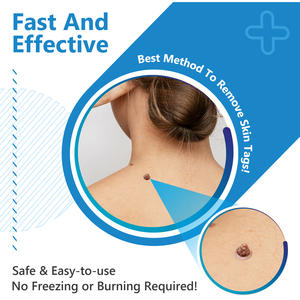 Para Aliver Atacado Pele Remoção Tag Pen Private Labels Removedor De Perucas Rolo Material Plástico - Product Image 4