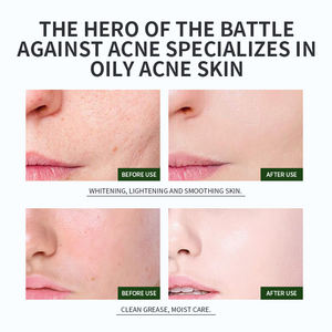 OEM Factory 140g estratto di tè verde essenza idratante maschera di fango idrata equilibra il tono della pelle previene le allergie per l'uso del viso - Product Image 3