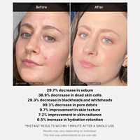 Sérum exfoliant lavable Medicube 21% AHA+BHA+acide succinique – Idéal pour les peaux à imperfections et sujettes aux boutons