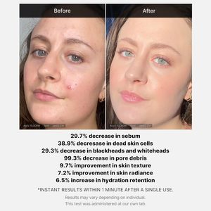 Medicube Exfoliant Acide 21% (AHA+BHA+Acide Succinique), Sérum Resurfaçant à Rincer, Idéal pour les Peaux Rugueuses et à Tendance Acnéique - Product Image 6
