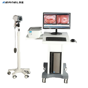 KN 2200 colposcope kỹ thuật số cho âm đạo phụ khoa colposcope Kernel KN-2200 Kernel colposcope - Product Image 1