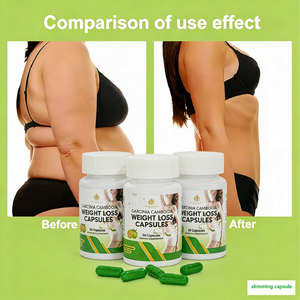 Cápsulas de Garcinia Cambogia para el Control de Peso en Adultos, Control del Apetito, Apoyo para las Articulaciones, Suplemento de Belleza, Salud Digestiva - Product Image 6