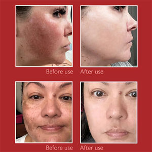 Crema Facial Iluminadora con Niacinamida 20g Ayuda a Mejorar el Tono de la Piel y Reducir la Apariencia de Manchas Oscuras y Pigmentación Desigual - Product Image 3