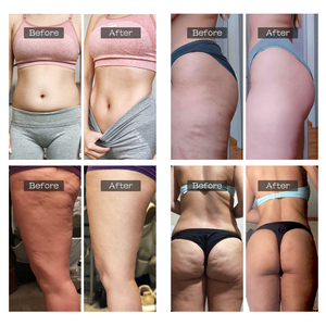 Rotlicht Saug muskel Körperform Abnehmen Massage Anti-Cellulite-Entfernung Bauch Fett verbrennungs gerät Anti Cellulite Massage gerät - Product Image 6