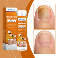 Spray réparateur pour les ongles, soin nourrissant doux pour les mains et les pieds, hydratant, adoucissant la peau morte