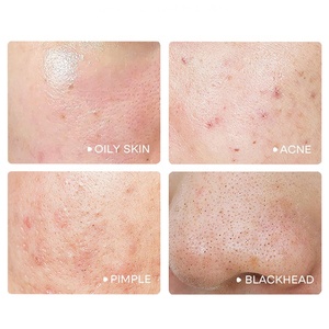 <span class=keywords><strong>Maschera</strong></span> Coreana al Fango di Sakura, Pulizia Profonda, Vegana, Idratante, per Sbiancamento Corpo, <span class=keywords><strong>Maschera</strong></span> Notturna <span class=keywords><strong>all</strong></span>'<span class=keywords><strong>Argilla</strong></span> Ispirata al Giappone - Product Image 3