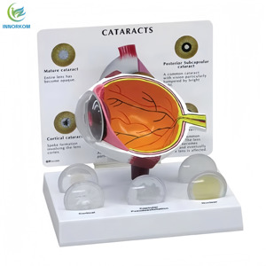 Modelo Anatómico Educativo de Ojo Humano con Cataratas, 6 Partes, 3D, Plástico, para Enseñanza de Ciencias Médicas - Product Image 3