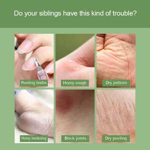 Crème pour les pieds à l'acide hyaluronique pour adultes peau morte blanchissant hydratant exfoliation crème pour - Product Image 3