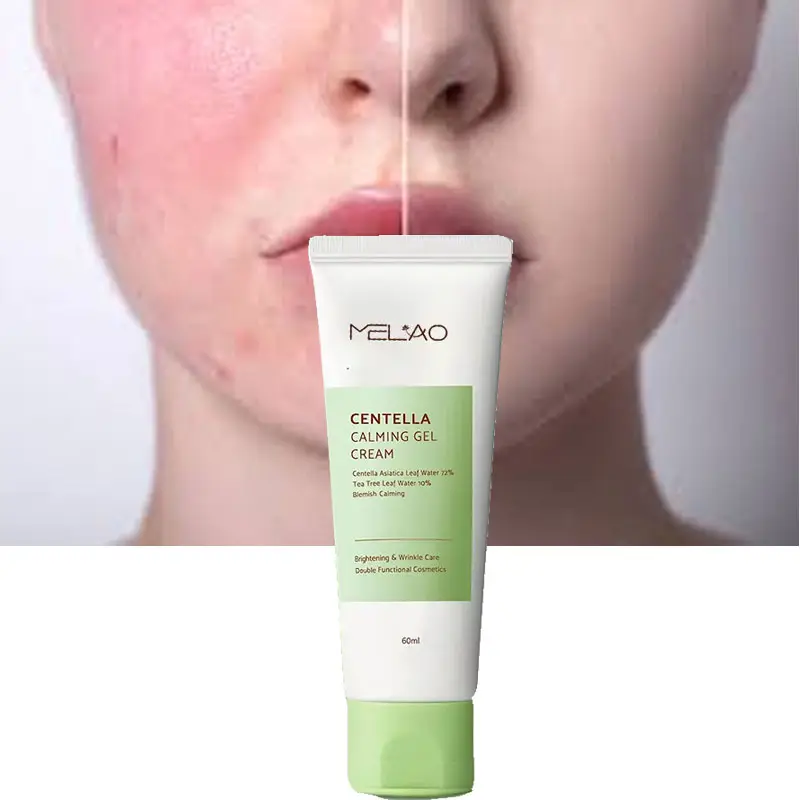 Sensitive Skin Calming Gel Moisturizer Acne Blemish Treatment Centella Gel Cream Face Lotion For Dry Skin Organic