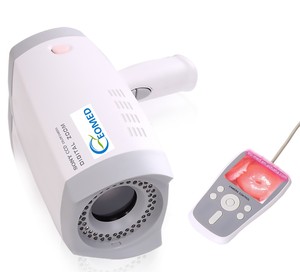 Draagbare Handheld Video Colposcoop DVC-9800B Inspectie Voor Vrouwelijke Gynaecologie <span class=keywords><strong>Vagina</strong></span> Onderzoek - Product Image 2