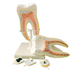 Nha sĩ MOL răng lớn có thể tháo rời Khoang nhựa giải phẫu giảng dạy mô hình trình diễn sinh học - Product Image 3