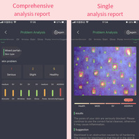 Analizador de Piel Profesional para iPad, Compatible con iOS y Android, Escáner Avanzado de Análisis de Pigmentación, de Fabricante Chino