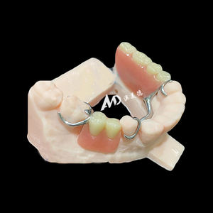 Protesi rimovibili personalizzate con struttura in metallo ripristinare la salute orale, facile da pulire, proteggere la pulizia orale - Product Image 4