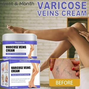 Allevia la vagina da flebite migliora la circolazione sanguigna crema per le vene Varicose - Product Image 6