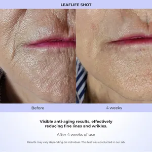 2024 Leaflife Nieuwe Innovatieve Koude Plasmapen/Thuisgebruik Schoonheid Apparatuur Anti-Aging Face Lift Rimpel Voor Gezicht En Nek