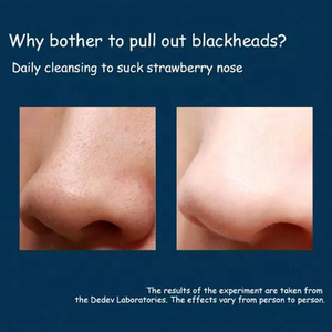 <span class=keywords><strong>Meilleur</strong></span> nettoyage en profondeur des pores anti-acné <span class=keywords><strong>soin</strong></span> de la peau grasse du <span class=keywords><strong>visage</strong></span> nettoyant pour le <span class=keywords><strong>visage</strong></span> pour hommes nettoyant pour le <span class=keywords><strong>visage</strong></span> de marque privée - Product Image 4