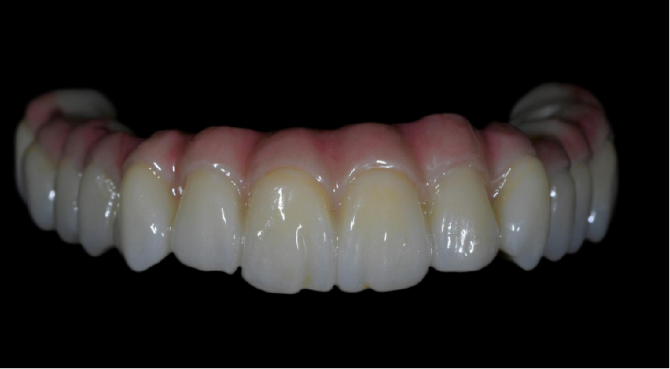 aidite zirconia block