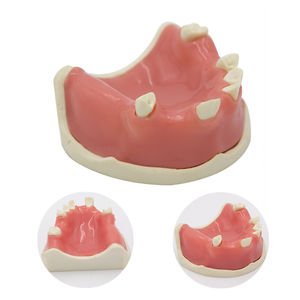Tandheelkundig model van kunststof voor oefening met tandheelkundige implantaten, training in tandheelkunde, mondheelkundig onderwijs, anatomisch model - Product Image 5