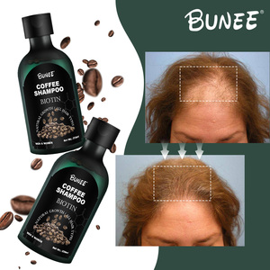 Tùy chỉnh sản phẩm caffeine chống rụng tóc dầu gội tóc mọc lại điều trị cà phê tăng trưởng dầu gội đầu với chất lượng tốt nhất - Product Image 2