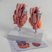 KyrenMed glande thyroïde et modèle pathologique Modèle de la glande thyroïde et des pathologies