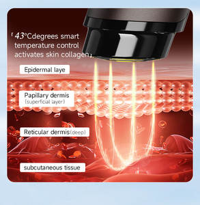 מכשיר יופי נייד בטכנולוגיית RF להצערת עור הפנים, הרמה, הפחתת קמטים וטיפול יומיומי - Product Image 4