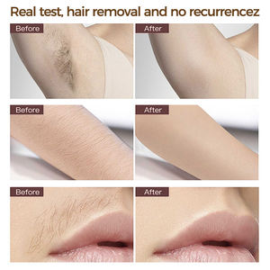 Épilateur IPL 3 en 1 pour l'épilation permanente du corps, du bikini, du visage, des jambes, du dos, des lèvres, des bras, des <span class=keywords><strong>aisselles</strong></span>, avec lunettes de protection, pour femmes - Product Image 4