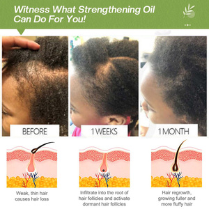 Etiqueta privada Cuidado del <span class=keywords><strong>cabello</strong></span> Extra fuerza Crecimiento y nutrición Niños Suero <span class=keywords><strong>para</strong></span> <span class=keywords><strong>el</strong></span> crecimiento del <span class=keywords><strong>cabello</strong></span> Natural Unisex Bebé Niños <span class=keywords><strong>Aceite</strong></span> <span class=keywords><strong>para</strong></span> <span class=keywords><strong>el</strong></span> crecimiento del <span class=keywords><strong>cabello</strong></span> - Product Image 5