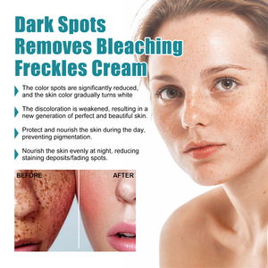 EELHOE sbiancante lentiggini <span class=keywords><strong>crema</strong></span> per la rimozione delle macchie scure Melasma scottature da sole macchie di gravidanza che riducono la pelle idratante <span class=keywords><strong>crema</strong></span> riparatrice - Product Image 5