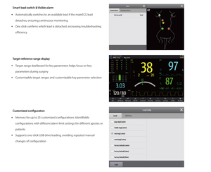 <span class=keywords><strong>Mindray</strong></span> EPM 12M Vet Ambulance Surgery e neonatale Icu ventilators per uso ospedaliero strumento veterinario linea di prodotti - Product Image 4