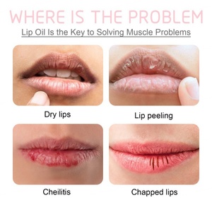 Natural Organic Foaming Lip Balm <b>Bubble</b> Lip Scrub Dark Lip Lightening Anti Cracked Hydrating Exfoliating Lip Line Care Lip Balm - Product Image 4