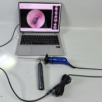 Endoscope industriel LED HD 3 mm à source de lumière froide USB Shanghai Xindi pour l'examen des oreilles et des cavités nasales des animaux 90°
