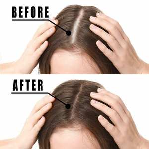 น้ำมันปลูกผมสำหรับผู้หญิงน้ำมันปลูกผมออร์แกนิกสำหรับผมร่วงฉลากส่วนตัวกำหนดโลโก้ได้เอง - Product Image 4