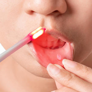 Cepillo de Dientes para Cuidado Dental Suave, Encías Sensibles, Cepillo de Dientes con Luz Roja, Nueva Tendencia Popular, Cepillo de Dientes con Calor - Product Image 6